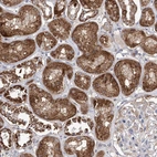 Immunohistochemical staining of human kidney shows strong cytoplasm granular positivity in cells in tubules.