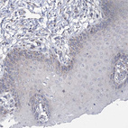 Anti-ECHDC3 Antibody