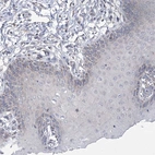 Immunohistochemical staining of human cervix, uterine shows no positivity in squamous epithelial cell as expected.