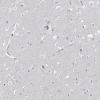 Anti-ECHDC3 Antibody