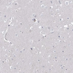 Immunohistochemical staining of human cerebral cortex shows no positivity in neuronal cells as expected.