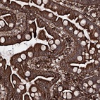 Anti-FGFR1OP2 Antibody