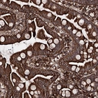 Anti-FGFR1OP2 Antibody
