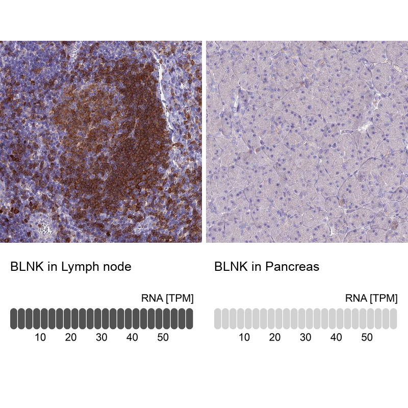 Anti-BLNK Antibody