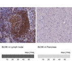 Anti-BLNK Antibody