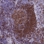 Immunohistochemical staining of human lymph node shows high expression.