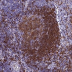 Immunohistochemical staining of human lymph node shows high expression.