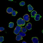 Immunofluorescent staining of human cell line REH shows localization to plasma membrane & cytoplasmic bodies.