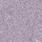 Immunohistochemical staining of human pancreas shows low expression as expected.
