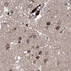 Immunohistochemical staining of human cerebral cortex using Anti-RPAP3 antibody HPA038311.