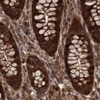 Immunohistochemical staining of human colon using Anti-RPAP3 antibody HPA038311.