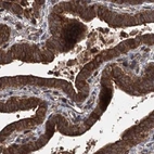 Immunohistochemical staining of human fallopian tube using Anti-RPAP3 antibody HPA038311.