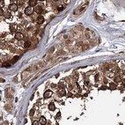 Immunohistochemical staining of human testis using Anti-RPAP3 antibody HPA038311.