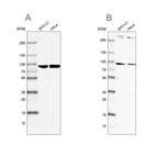 Western blot analysis using Anti-RPAP3 antibody HPA038311 (A) shows similar pattern to independent antibody HPA038312 (B).