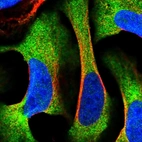 Immunofluorescent staining of human cell line U-2 OS shows positivity in cytoplasm.