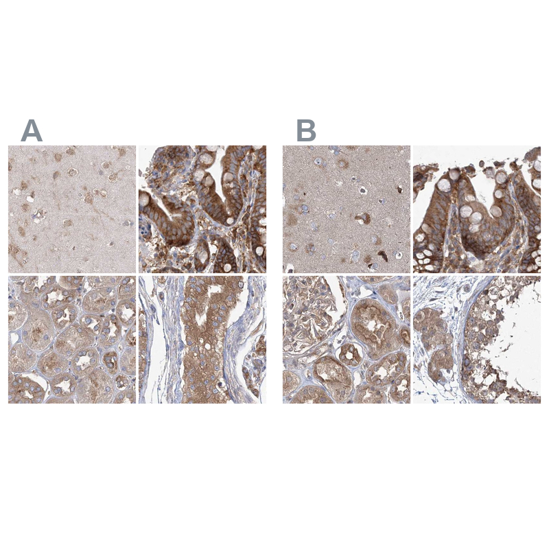 Anti-EIF3A Antibody