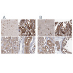 Anti-EIF3A Antibody