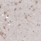 Immunohistochemical staining of human cerebral cortex using Anti-EIF3A antibody HPA038315.