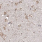 Immunohistochemical staining of human cerebral cortex using Anti-EIF3A antibody HPA038315.