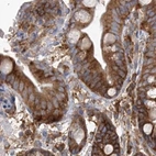Immunohistochemical staining of human colon using Anti-EIF3A antibody HPA038315.