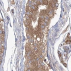 Immunohistochemical staining of human testis using Anti-EIF3A antibody HPA038315.
