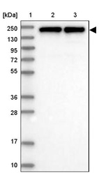 Lane 1: Marker [kDa] 250, 130, 95, 72, 55, 36, 28, 17, 10_br/_Lane 2: Human cell line RT-4_br/_Lane 3: Human cell line U-251MG sp