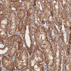 Anti-DHX29 Antibody