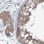 Immunohistochemical staining of human testis using Anti-EIF3A antibody HPA038316.