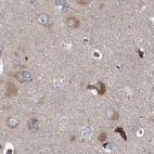 Immunohistochemical staining of human cerebral cortex using Anti-EIF3A antibody HPA038316.