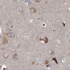Immunohistochemical staining of human cerebral cortex using Anti-EIF3A antibody HPA038316.