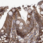 Immunohistochemical staining of human colon using Anti-EIF3A antibody HPA038316.