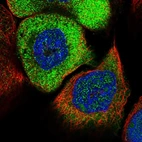 Immunofluorescent staining of human cell line A-431 shows positivity in nucleus & cytoplasm.