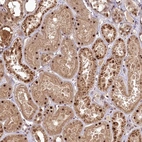 Immunohistochemical staining of human kidney shows moderate to strong nuclear positivity in cells in tubules.