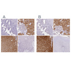 Immunohistochemical staining of human endometrium, kidney, liver and squamous epithelia using Anti-HPD antibody HPA038321 (A) shows similar protein distribution across tissues to independent antibody HPA038322 (B).