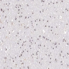 Immunohistochemical staining of human cerebral cortex shows moderate to strong nuclear positivity in neurons.
