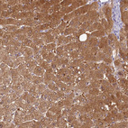Immunohistochemical staining of human liver shows strong cytoplasmic positivity in hepatocytes.