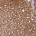 Immunohistochemical staining of human liver shows strong cytoplasmic positivity in hepatocytes.