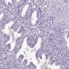 Immunohistochemical staining of human endometrium shows no positivity in glandular cells as expected.