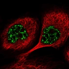 Immunofluorescent staining of human cell line A-431 shows localization to nuclear speckles.