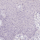 Immunohistochemical staining of human squamous epithelia shows no positivity in squamous epithelial cells as expected.