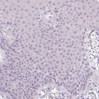 Immunohistochemical staining of human squamous epithelia shows no positivity in squamous epithelial cells as expected.