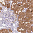 Immunohistochemical staining of human kidney shows strong cytoplasmic positivity in cells in tubules.