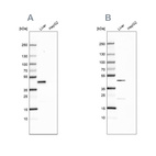 Western blot analysis using Anti-HPD antibody HPA038321 (A) shows similar pattern to independent antibody HPA038322 (B).
