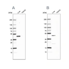 Western blot analysis using Anti-HPD antibody HPA038321 (A) shows similar pattern to independent antibody HPA038322 (B).