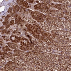 Anti-ST7 Antibody