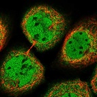 Immunofluorescent staining of human cell line A-431 shows localization to nucleoplasm & cytosol.