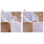 Immunohistochemical staining of human endometrium, kidney, liver and squamous epithelia using Anti-HPD antibody HPA038322 (A) shows similar protein distribution across tissues to independent antibody HPA038321 (B).
