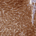 Immunohistochemical staining of human liver shows strong cytoplasmic positivity in hepatocytes.
