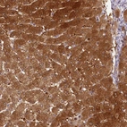 Immunohistochemical staining of human liver shows strong cytoplasmic positivity in hepatocytes.
