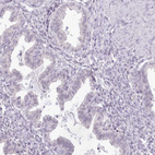 Immunohistochemical staining of human endometrium shows no positivity in glandular cells as expected.